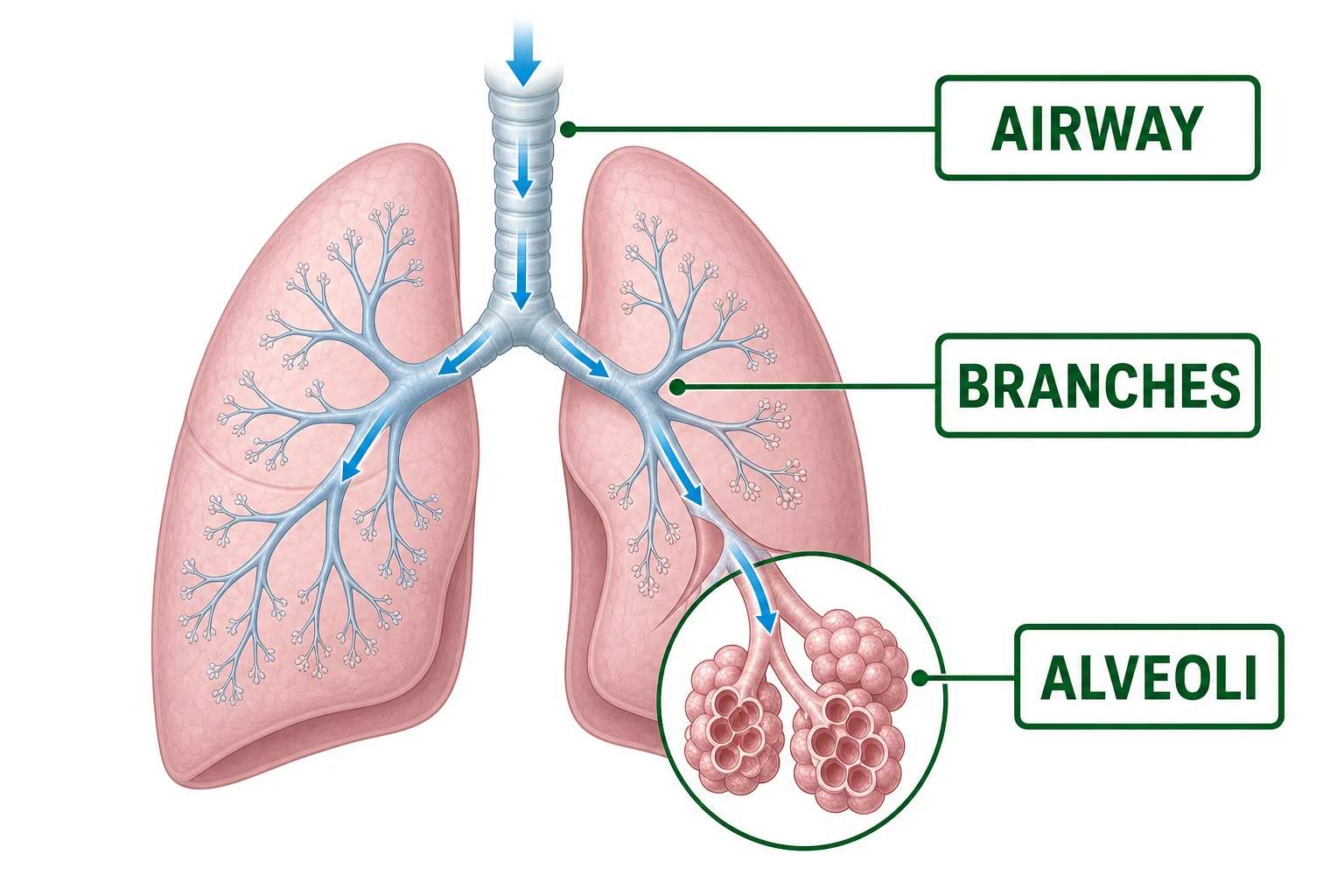 Branching airway diagram showing the trachea, bronchi, bronchioles, and clusters of alveoli at the ends