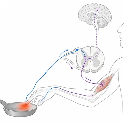 Hand touching a hot pan with a nerve pathway through the spinal cord causing withdrawal.