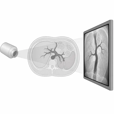 Contrast material makes certain vessels or organs stand out on an X-ray detector.